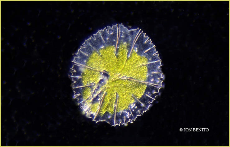 Alga unicelular Micrasterias spp. Mostrando sus cloroplastos